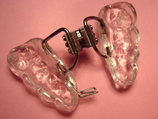 Ortodoncia, diyunción