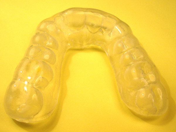 Ortodoncia, férulas