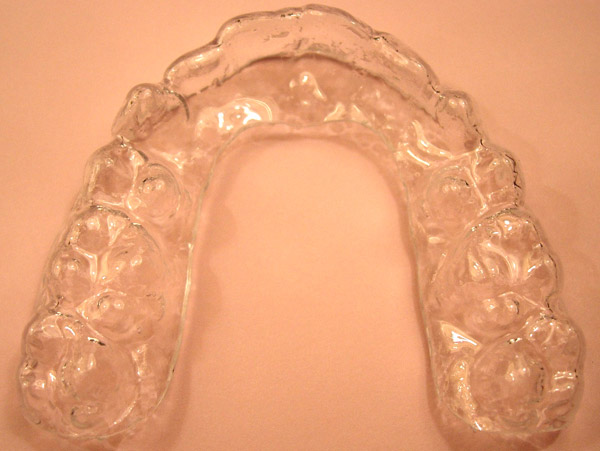 Ortodoncia, retención