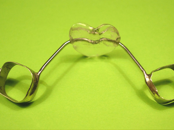 Ortodoncia, Aparatolog&iacute;a fija