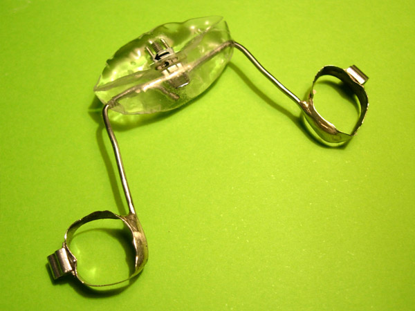 Ortodoncia, Aparatolog&iacute;a fija