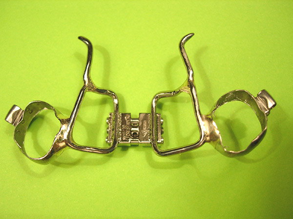 Ortodoncia, Aparatolog&iacute;a fija