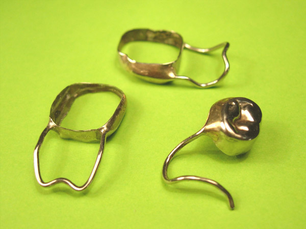 Ortodoncia, Aparatolog&iacute;a fija