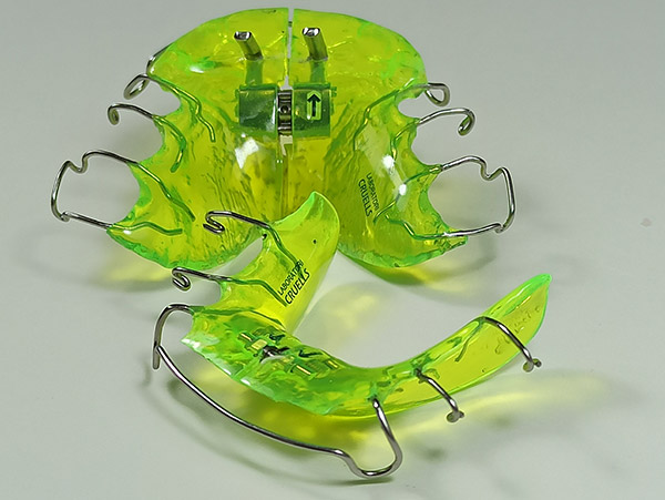 Ortodoncia, Aparatolog&iacute;a Funcional