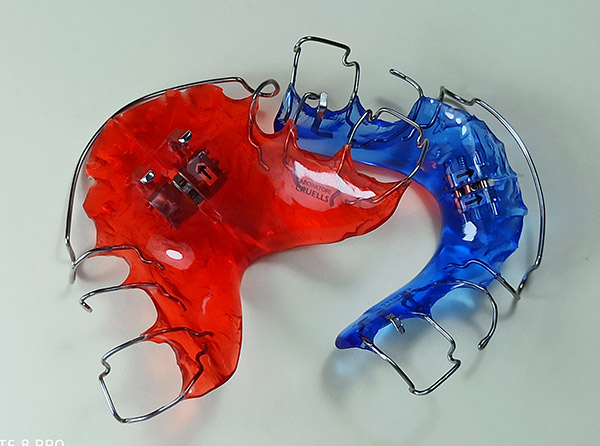 Ortodoncia, Aparatolog&iacute;a Funcional