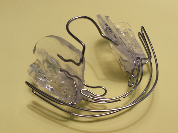 Ortodoncia, Aparatolog&iacute;a Funcional