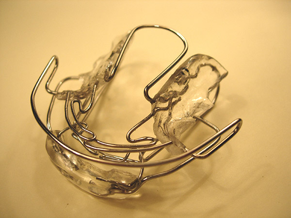 Ortodoncia, Aparatolog&iacute;a Funcional