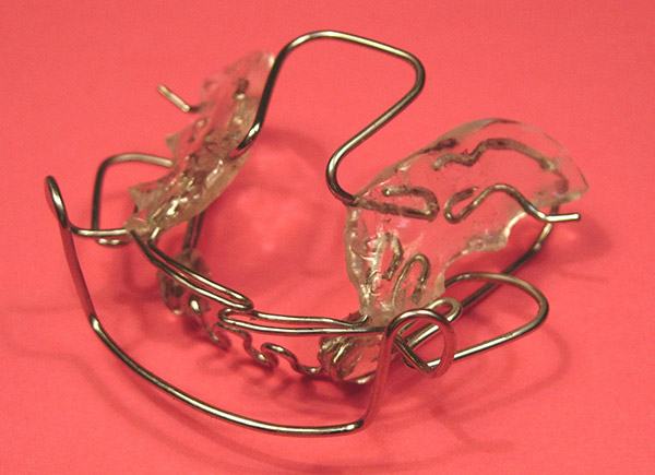 Ortodoncia, Aparatolog&iacute;a Funcional