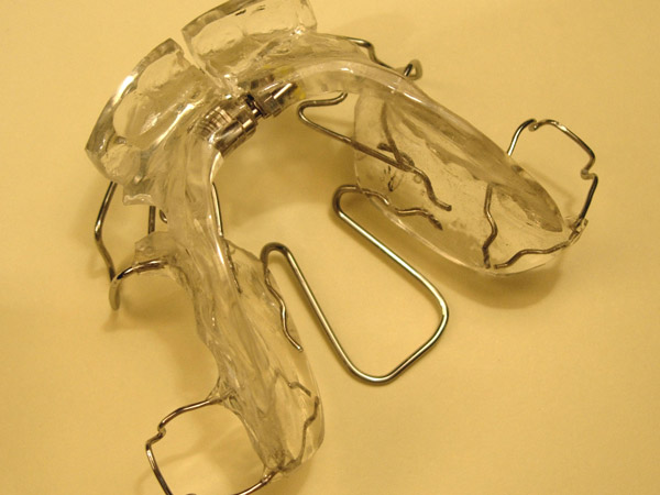 Ortodoncia, Aparatolog&iacute;a Funcional