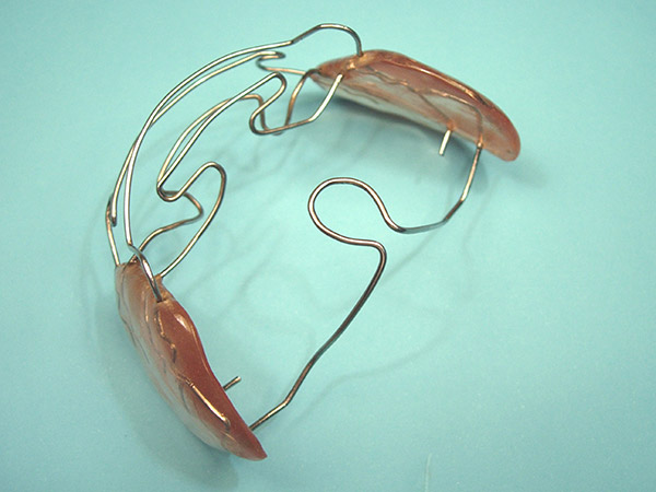 Ortodoncia, Aparatolog&iacute;a Funcional