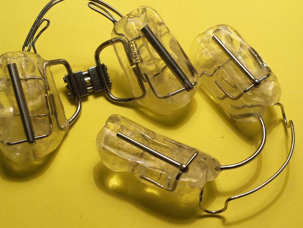 Ortodoncia, Aparatolog&iacute;a Funcional