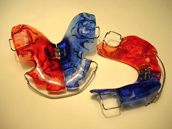 Ortodoncia, Aparatolog&iacute;a Funcional