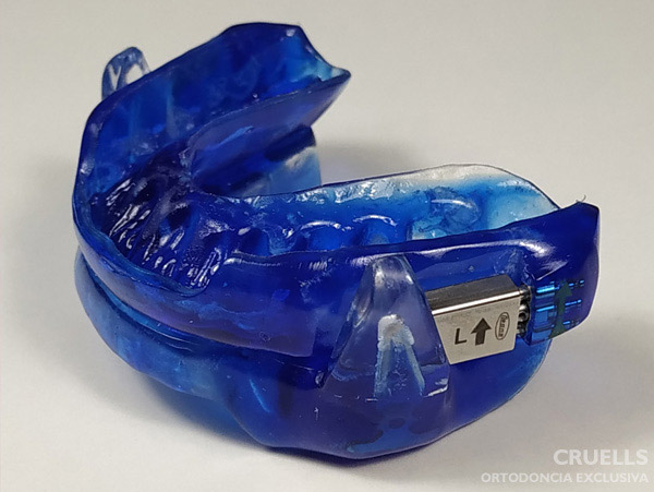 Ortodoncia, aparatos apnea