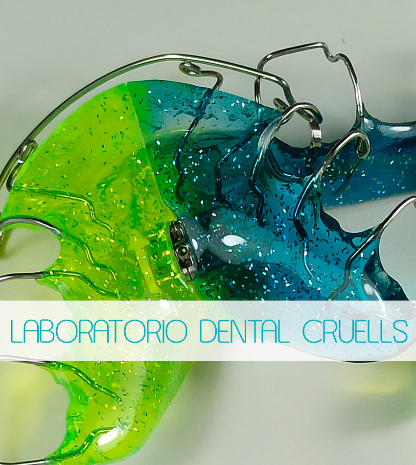 Ortodoncia, Aparatolog&iacute;a fija