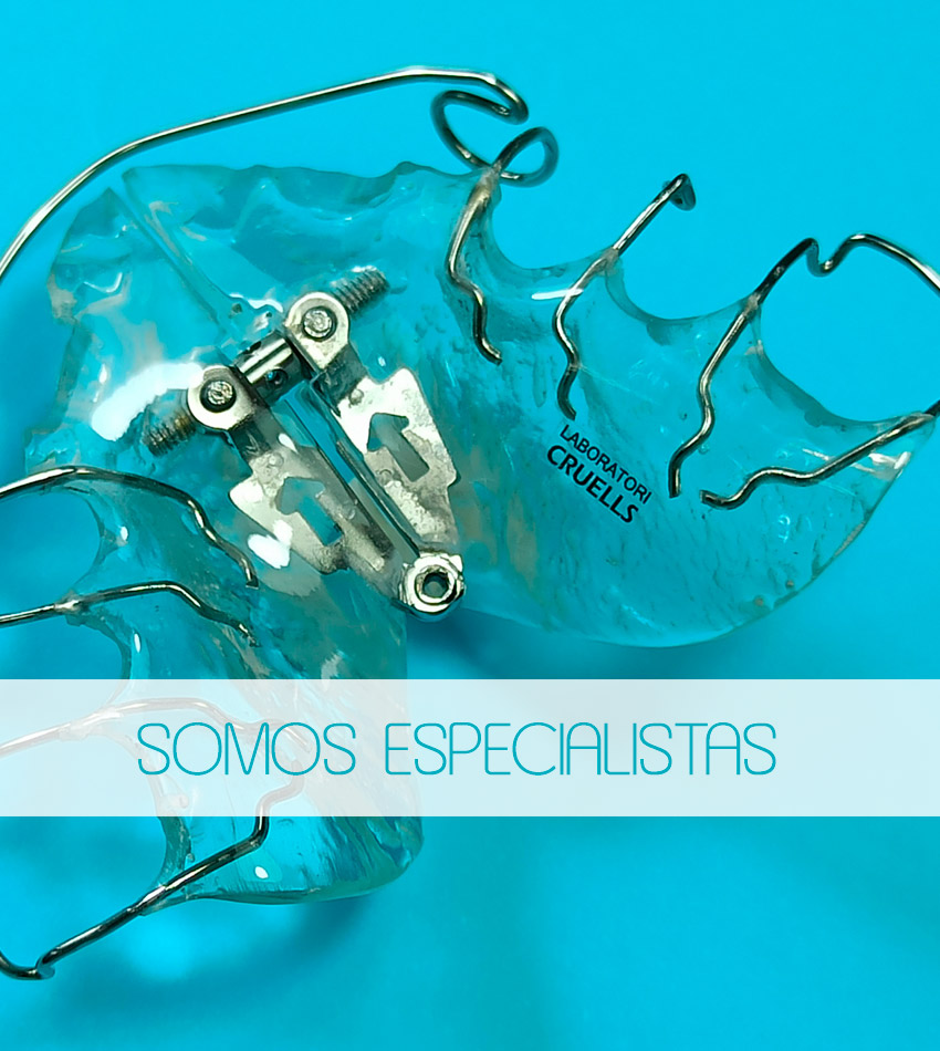 Ortodoncia, Aparatolog&iacute;a fija