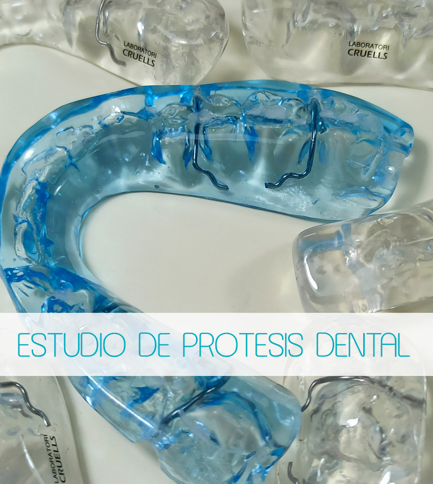 Ortodoncia, Aparatolog&iacute;a fija