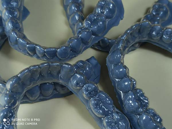 Ortodoncia, Aparatolog&iacute;a fija