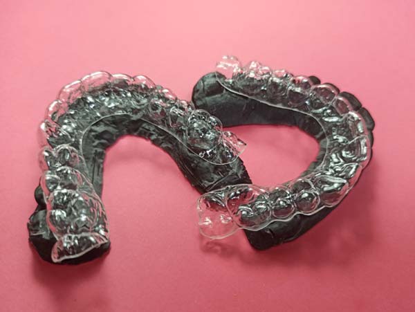 Ortodoncia, Aparatolog&iacute;a fija