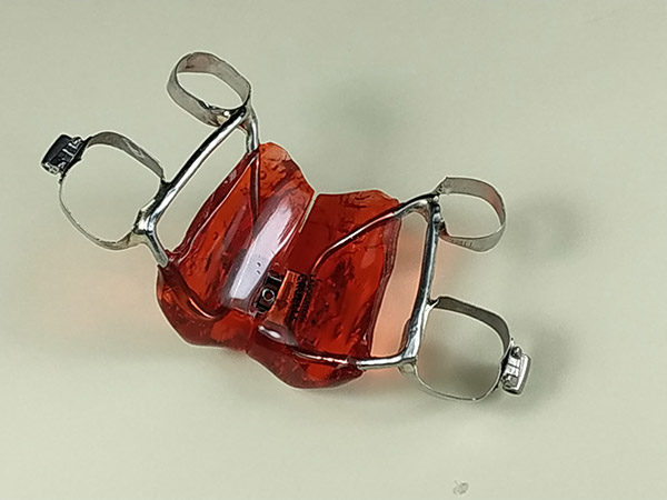 Ortodoncia, diyunci&oacute;n