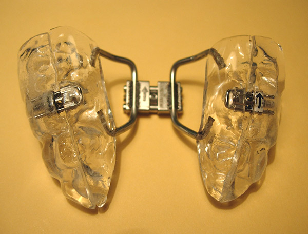 Ortodoncia, diyunci&oacute;n