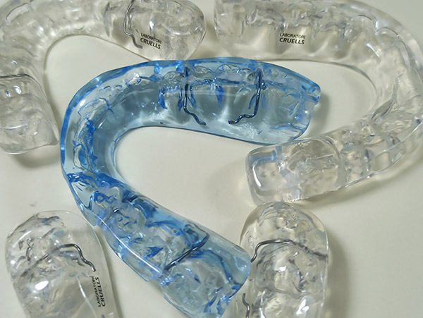 Ortodoncia, f&eacute;rulas