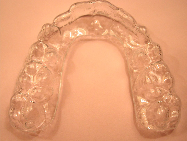 Ortodoncia, f&eacute;rulas