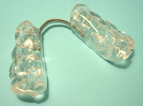 Ortodoncia, f&eacute;rulas