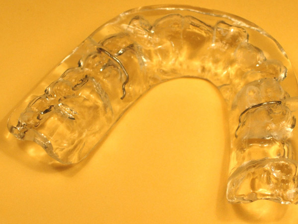 Ortodoncia, f&eacute;rulas