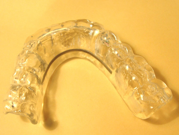 Ortodoncia, f&eacute;rulas