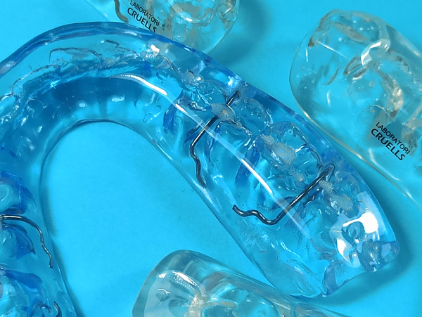 Ortodoncia, f&eacute;rulas