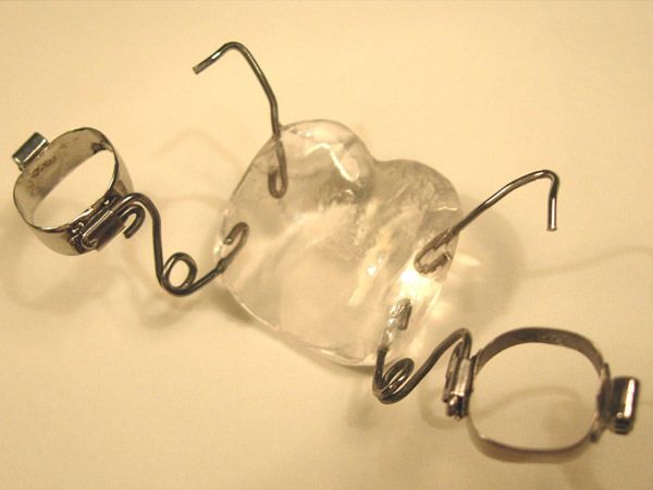 Ortodoncia, P&eacute;ndulo de Hilguers