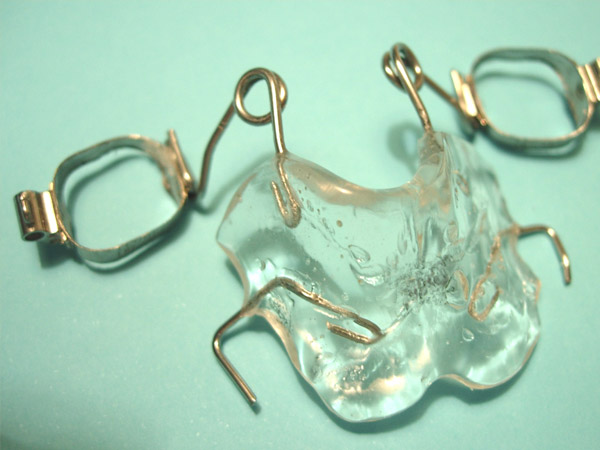 Ortodoncia, P&eacute;ndulo de Hilguers