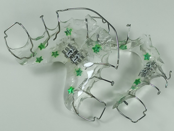 Ortodoncia, Plaxcas Activas