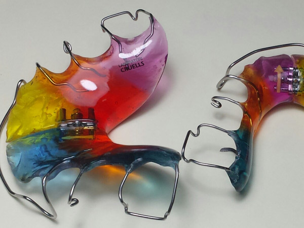 Ortodoncia, Plaxcas Activas