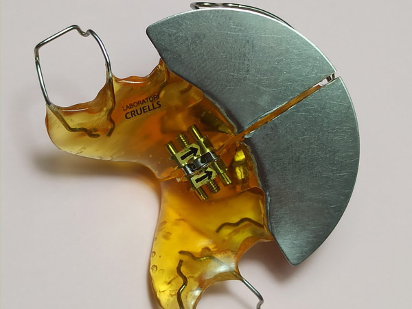 Ortodoncia, Plaxcas Activas