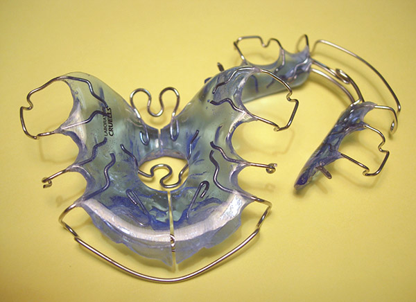 Ortodoncia, Plaxcas Activas