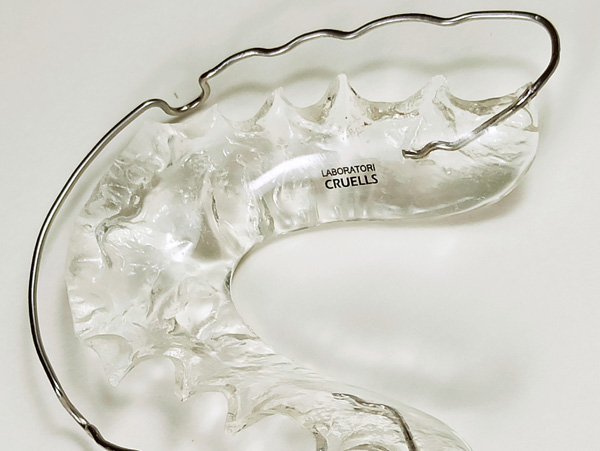 Ortodoncia, retenci&oacute;n