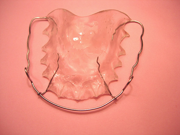 Ortodoncia, retenci&oacute;n