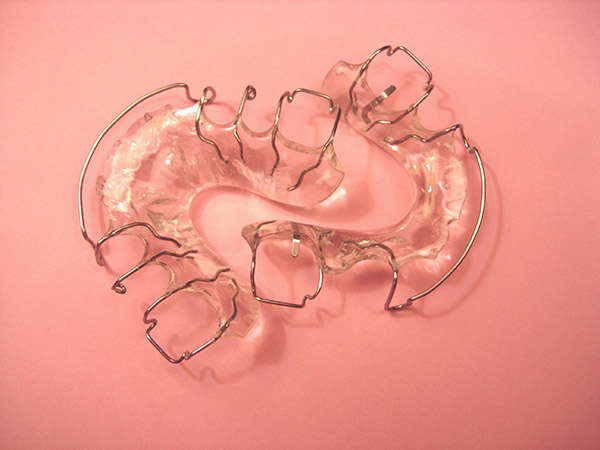 Ortodoncia, retenci&oacute;n